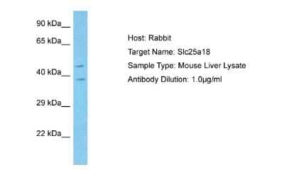 Western Blot: SLC25A18 Antibody [NBP2-84265] - Host: Rabbit. Target Name: SLC25A18. Sample Tissue: Mouse Liver lysates. Antibody Dilution: 1ug/ml