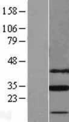 Western Blot: SLC25A18 Overexpression Lysate (Adult Normal) [NBL1-16053] Left-Empty vector transfected control cell lysate (HEK293 cell lysate); Right -Over-expression Lysate for SLC25A18.