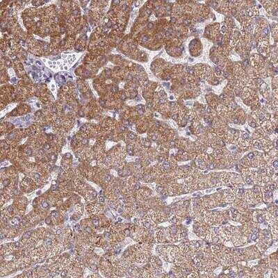 Immunohistochemistry: SLC25A2 Antibody [NBP2-13320] - Staining of human liver shows moderate cytoplasmic positivity in hepatocytes.