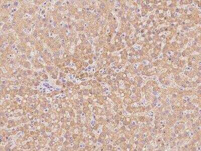 Immunohistochemistry-Paraffin: SLC25A2 Antibody [NBP3-06289] - Immunochemical staining of human SLC25A2 in human liver with rabbit polyclonal antibody at 1:100 dilution, formalin-fixed paraffin embedded sections.