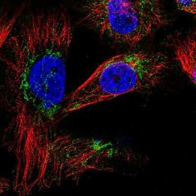 Immunocytochemistry/Immunofluorescence: SLC25A20 Antibody [NBP1-86689] - Staining of human cell line U-251 MG shows positivity in cytoplasm and mitochondria. Antibody staining is shown in green.