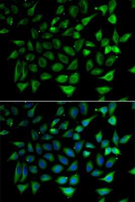 Immunocytochemistry/Immunofluorescence: SLC25A20 Antibody [NBP3-04656] - Analysis of HeLa cells using SLC25A20 antibody . Blue: DAPI for nuclear staining.