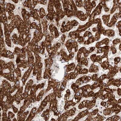 Immunohistochemistry-Paraffin: SLC25A20 Antibody [NBP1-86689] - Staining of human liver shows strong cytoplasmic positivity in hepatocytes.