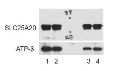 Western Blot: SLC25A20 Antibody [NBP1-86690] - Analysis of SLC25A20 in murine ear mesenchymal stem cells (mEMSC) adipocytes using anti-SLC25A20 antibody. Image from verified customer review.