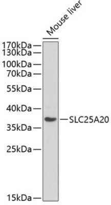 Western Blot: SLC25A20 Antibody [NBP2-94292] - Analysis of extracts of mouse liver, using SLC25A20 at 1:1000 dilution.Secondary antibody: HRP Goat Anti-Rabbit IgG (H+L) at 1:10000 dilution.Lysates/proteins: 25ug per lane.Blocking buffer: 3% nonfat dry milk in TBST.Detection: ECL Basic Kit .Exposure time: 90s.