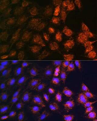 Immunocytochemistry/Immunofluorescence: SLC25A22 Antibody [NBP2-94069] - Analysis of C6 cells using SLC25A22 at dilution of 1:100. Blue: DAPI for nuclear staining.