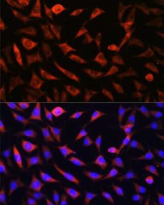 Immunocytochemistry/Immunofluorescence: SLC25A22 Antibody [NBP2-94069] - Analysis of L929 cells using SLC25A22 at dilution of 1:100. Blue: DAPI for nuclear staining.