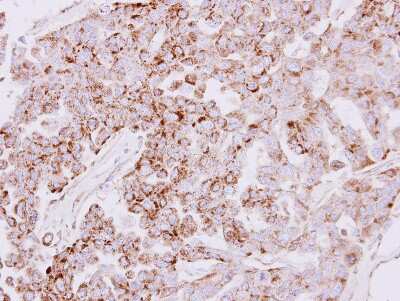 Immunohistochemistry-Paraffin: SLC25A22 Antibody [NBP1-33385] - Paraffin-embedded OVCAR3 xenograft, using antibody at 1:500 dilution.