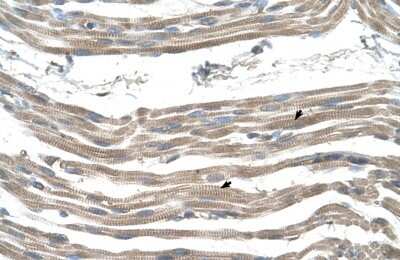 Immunohistochemistry-Paraffin: SLC25A22 Antibody [NBP1-59603] - Human Muscle Tissue, Skeletal muscle cells (Indicated with Arrows) 4-8ug/ml.