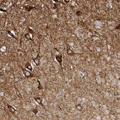 Immunohistochemistry-Paraffin: SLC25A22 Antibody [NBP1-84880] - Staining of human hippocampus shows strong cytoplasmic positivity in neuronal cells and neuropil.