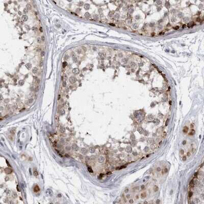 Immunohistochemistry-Paraffin: SLC25A22 Antibody [NBP1-84880] - Staining of human testis shows strong granular positivity in cytoplasm in a subset of cells in seminiferous ducts.