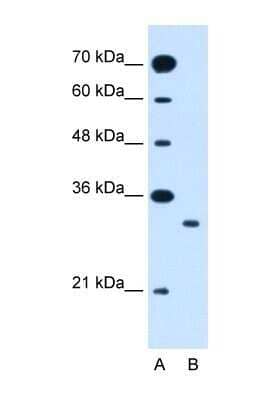 Western Blot: SLC25A22 Antibody [NBP1-59603] - Jurkat cell lysate, Antibody Titration: 1.25ug/ml