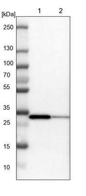 Western Blot: SLC25A22 Antibody [NBP1-84880] - Lane 1: NIH-3T3 cell lysate (Mouse embryonic fibroblast cells). Lane 2: NBT-II cell lysate (Rat Wistar bladder tumor cells).