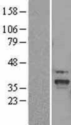 Western Blot: SLC25A22 Overexpression Lysate (Adult Normal) [NBL1-16055] Left-Empty vector transfected control cell lysate (HEK293 cell lysate); Right -Over-expression Lysate for SLC25A22.