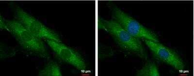 Immunocytochemistry/Immunofluorescence: SLC25A23 Antibody [NBP2-20389] - SK-N-SH cells were fixed in 2% paraformaldehyde/culture medium at 37c for 30 min. Green: SLC25A23 protein stained by SLC25A23 antibody  diluted at 1:500. Blue: Hoechst 33342 staining.