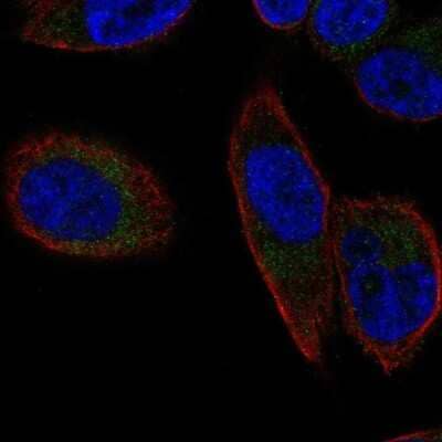 Immunocytochemistry/Immunofluorescence: SLC25A23 Antibody [NBP2-58927] - Staining of human cell line PC-3 shows localization to mitochondria.