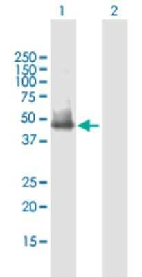 Western Blot: SLC25A23 Antibody [H00079085-B01P] - Analysis of SLC25A23 expression in transfected 293T cell line by SLC25A23 polyclonal antibody.  Lane 1: SLC25A23 transfected lysate(53.02 KDa). Lane 2: Non-transfected lysate.