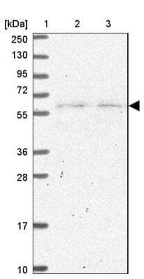 Western Blot: SLC25A23 Antibody [NBP2-13321] - Lane 1: Marker  [kDa] 250, 130, 95, 72, 55, 36, 28, 17, 10.  Lane 2: Human cell line RT-4.  Lane 3: Human cell line U-251MG sp