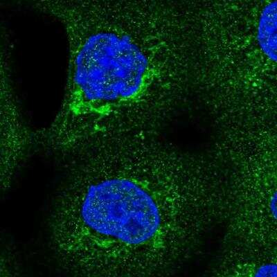 <b>Independent Antibodies Validation. </b>Immunocytochemistry/Immunofluorescence: SLC25A24 Antibody [NBP1-89049] - Staining of human cell line A-431 shows localization to mitochondria. Antibody staining is shown in green.