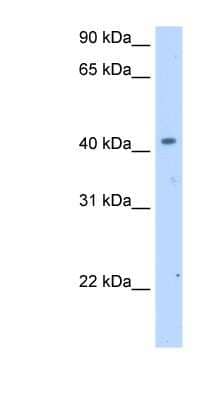 Western Blot: SLC25A24 Antibody [NBP1-60063] - Human Thymus lysate, concentration 2.5 ug/ml.