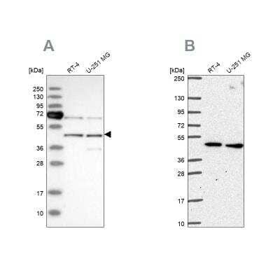 Western Blot: SLC25A24 Antibody [NBP1-89049] - Analysis using Anti-SLC25A24 antibody NBP1-89049 (A) shows similar pattern to independent antibody NBP2-57669 (B).