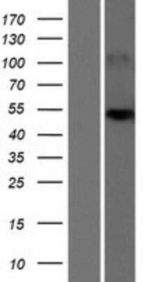 Western Blot: SLC25A24 Overexpression Lysate (Adult Normal) [NBP2-04468] Left-Empty vector transfected control cell lysate (HEK293 cell lysate); Right -Over-expression Lysate for SLC25A24.