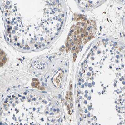 Immunohistochemistry-Paraffin: SLC25A25 Antibody [NBP1-82886] - Staining of human testis shows moderate cytoplasmic positivity in Leydig cells.