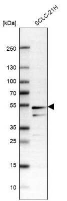 Western Blot: SLC25A25 Antibody [NBP1-82886] - Analysis in human cell line SCLC-21H.