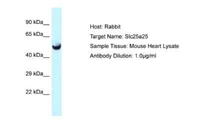 Western Blot: SLC25A25 Antibody [NBP2-88290] - Host: Rabbit. Target Name: Slc25a25. Sample Type: Mouse Heart lysates. Antibody Dilution: 1.0ug/ml