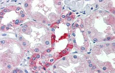 Immunohistochemistry-Paraffin: SLC25A28 Antibody [NBP1-59562] - Human kidney Tissue, antibody concentration  5 ug/ml.