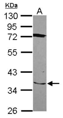 Western Blot: SLC25A28 Antibody [NBP2-20390] - Sample (30 ug of whole cell lysate) A: NT2D1 10% SDS PAGE gel, diluted at 1:2000.