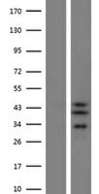 Western Blot SLC25A28 Overexpression Lysate