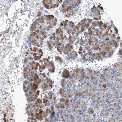 Immunohistochemistry-Paraffin: SLC25A29 Antibody [NBP1-88425] - Staining of human pancreas shows moderate cytoplasmic positivity in exocrine glandular cells.