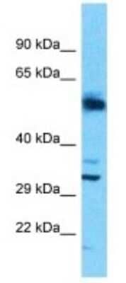 Western Blot SLC25A30 Antibody