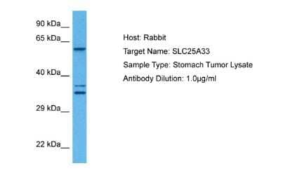 Western Blot: SLC25A33 Antibody [NBP2-85740] - Host: Rabbit. Target Name: SLC25A33. Sample Tissue: Human Stomach Tumor lysates. Antibody Dilution: 1ug/ml