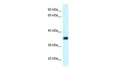 Western Blot: SLC25A33 Antibody [NBP2-85741] - WB Suggested Anti-SLC25A33 Antibody. Titration: 1.0 ug/ml. Positive Control: ACHN Whole Cell