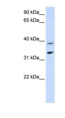 Western Blot: SLC25A34 Antibody [NBP1-59607] - Human Placenta lysate, concentration 0.2-1 ug/ml.