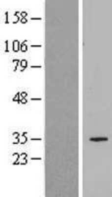 Western Blot: SLC25A34 Overexpression Lysate (Adult Normal) [NBL1-16063] Left-Empty vector transfected control cell lysate (HEK293 cell lysate); Right -Over-expression Lysate for SLC25A34.