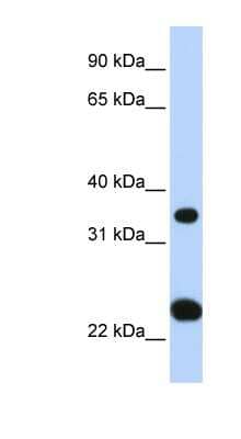 Western Blot: SLC25A35 Antibody [NBP1-59606] - Human Liver cell lysate, concentration 0.2-1 ug/ml.