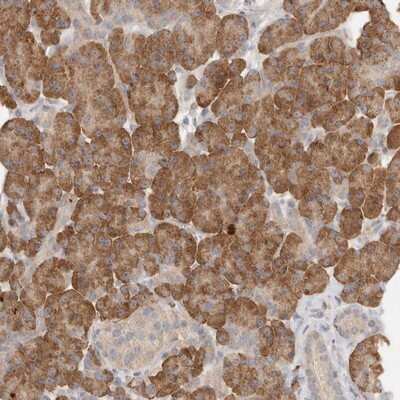 Immunohistochemistry-Paraffin: SLC25A36 Antibody [NBP1-84617] - Staining of human pancreas shows moderate cytoplasmic positivity in exocrine glandular cells.