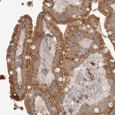 Immunohistochemistry-Paraffin: SLC25A36 Antibody [NBP1-84617] - Staining of human Duodenum shows moderate granular cytoplasmic  positivity in glandular cells.
