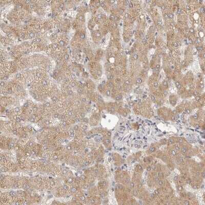 Immunohistochemistry-Paraffin: SLC25A36 Antibody [NBP1-84617] - Staining of human Liver shows very weak granular cytoplasmic  positivity in hepatocytes.