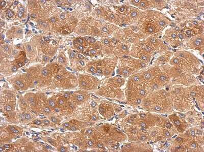 Immunohistochemistry-Paraffin SLC25A36 Antibody