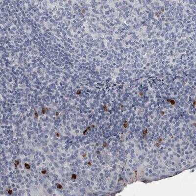 Immunohistochemistry-Paraffin: SLC25A39 Antibody [NBP1-84502] - Staining of human tonsil shows strong cytoplasmic positivity in subsets of lymphoid cells.