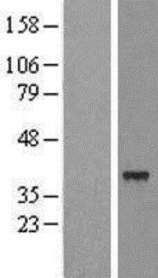 Western Blot: SLC25A39 Overexpression Lysate (Adult Normal) [NBL1-16066] - Left - Empty vector transfected control cell lysate (HEK293 cell lysate); Right - Over-expression Lysate for SLC25A39.