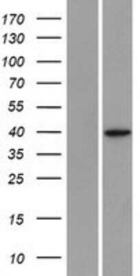 Western Blot: SLC25A39 Overexpression Lysate (Adult Normal) [NBP2-09681] Left-Empty vector transfected control cell lysate (HEK293 cell lysate); Right -Over-expression Lysate for SLC25A39.