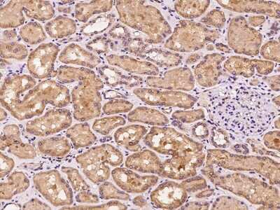 Immunohistochemistry-Paraffin: SLC25A42 Antibody [NBP2-98611] - Staining of human SLC25A42 in human kidney with rabbit polyclonal antibody at 1:100 dilution.