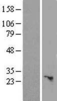 Western Blot: SLC25A45 Overexpression Lysate (Adult Normal) [NBL1-16071] Left-Empty vector transfected control cell lysate (HEK293 cell lysate); Right -Over-expression Lysate for SLC25A45.