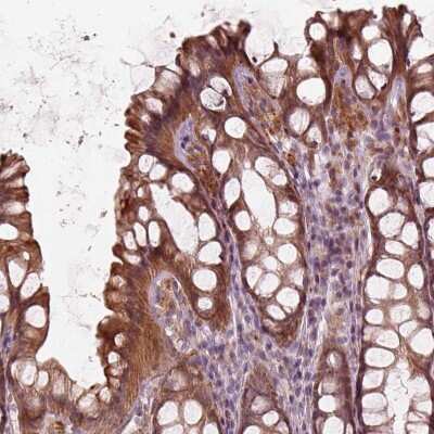 Immunohistochemistry-Paraffin: SLC25A46 Antibody [NBP2-57347] - Immunohistochemical staining of human colon shows strong cytoplasmic positivity in glandular cells.