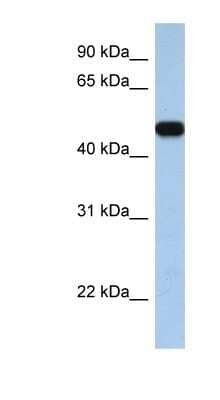 Western Blot: SLC25A46 Antibody [NBP1-59604] - MCF-7 whole cell lysates, concentration 0.2-1 ug/ml.